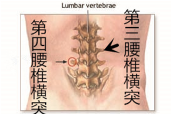 身体采取侧卧位,需要治疗的一侧朝上,如下图所示,找到第三腰椎横突
